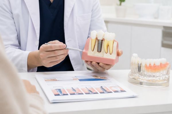 インプラント治療の特徴を説明するイメージ