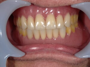 71歳男性：before画像
